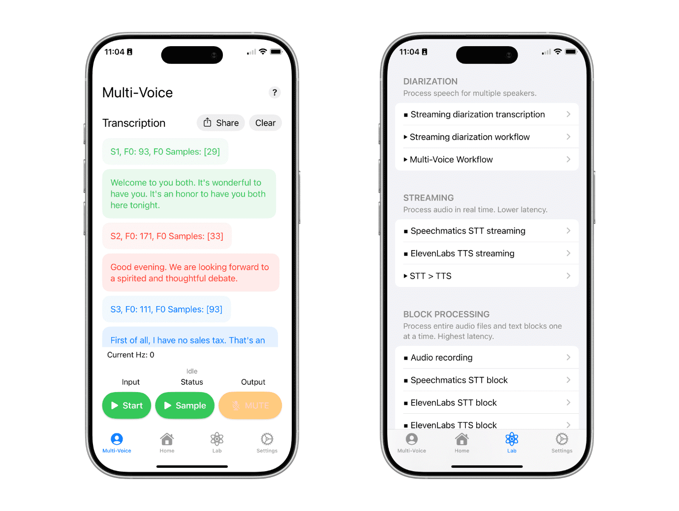 SpeechAid multi-voice transcription screen and processing lab screen